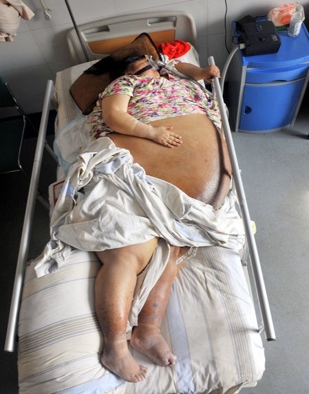 ��̸����Ů�����ֲ� ��������200���ͼ��